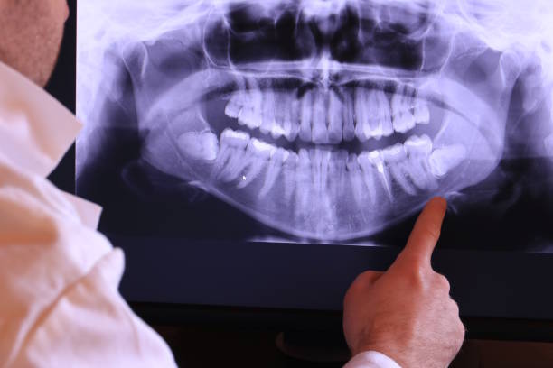 Best Emergency Root Canal Treatment in Sun Lakes, AZ